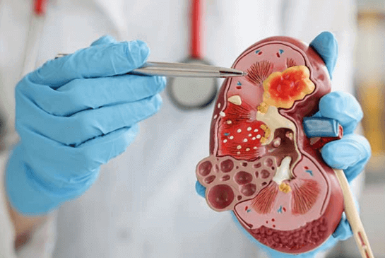 Nephrology